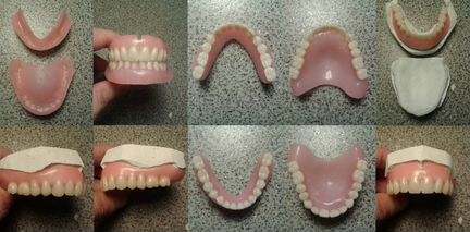 Съёмные зубные протезы на дому у клиента