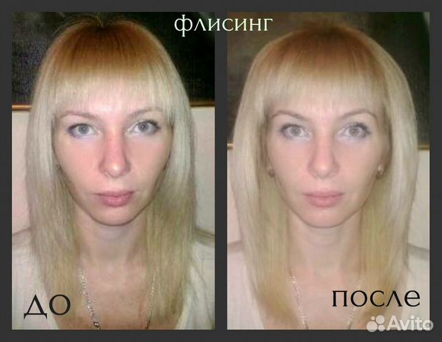 Прикорневой объем надолго