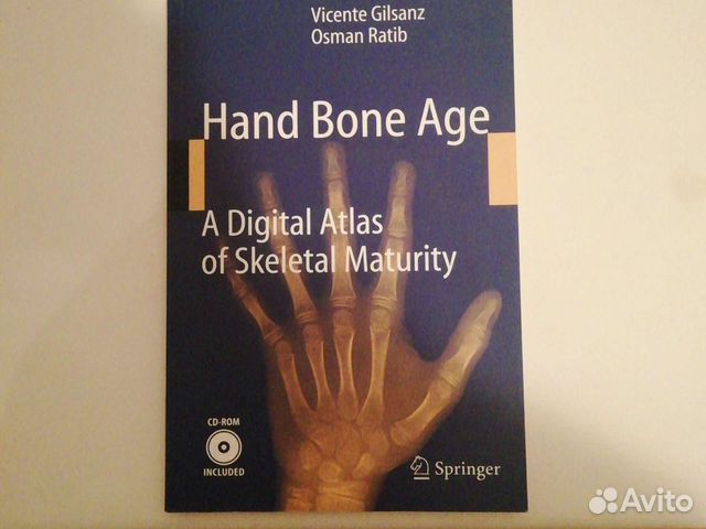 Bone age