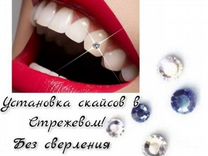 Скайсы на зубы Томск Сплавной 3-й Лечение кариеса лазером Томск Проточная