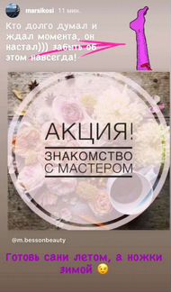 Электроэпиляция